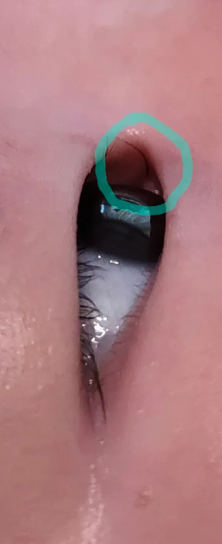 아기 속눈썹