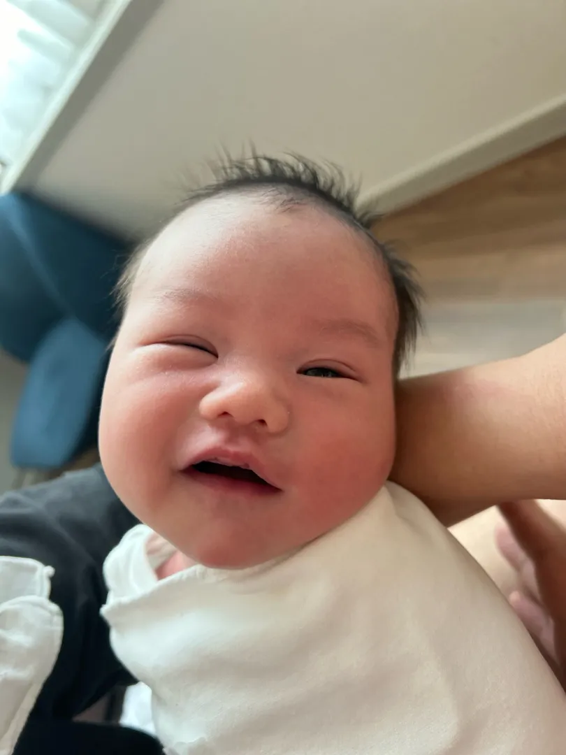 유도분만 실패 응급제왕