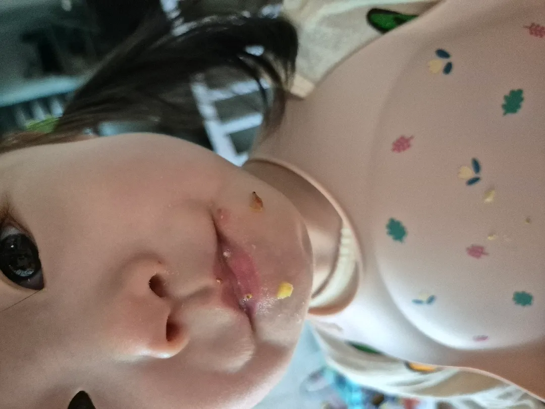 헤르페스인가요?ㅜ