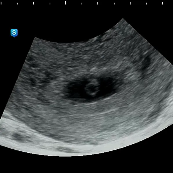 오늘 심장소리 듣구 왔어요! 심박수 어떤가요?