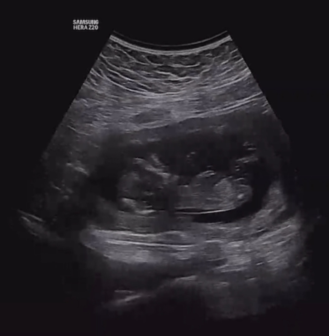 각도법 봐줄 분 계신가요..?