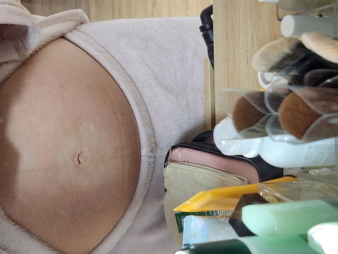 배꼬주위 색깔