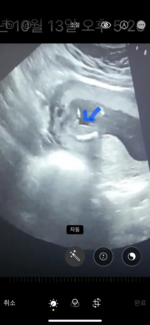 딸이라고 예기들었는데 영상보니까 
