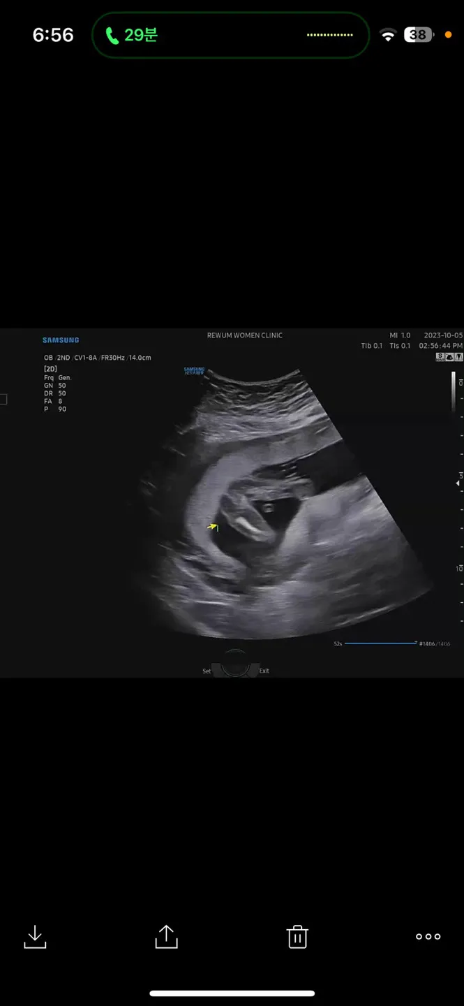 딸이 맞을까요??