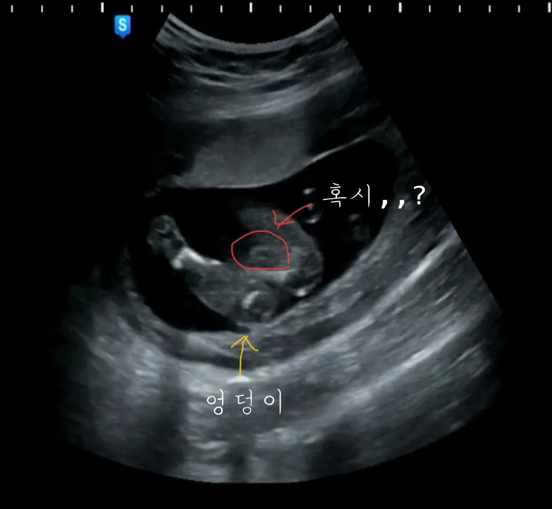 18주차 여->남 성별반전,,?!