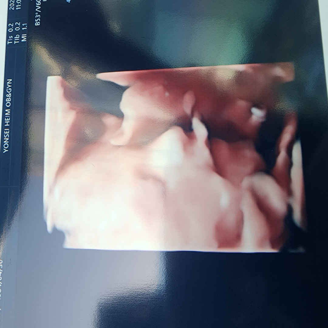 30주 3일차 태아 입초 성공했어요