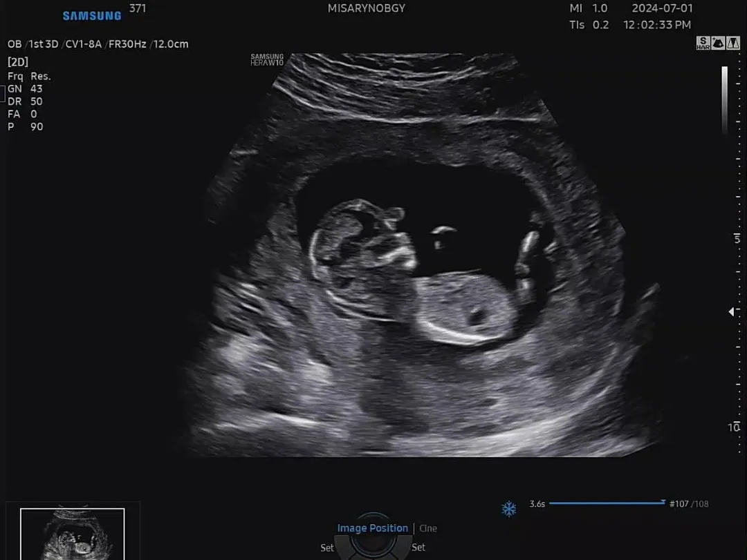 13주4일 각도법 알려즈세용🙏🏻👶🏻🩷