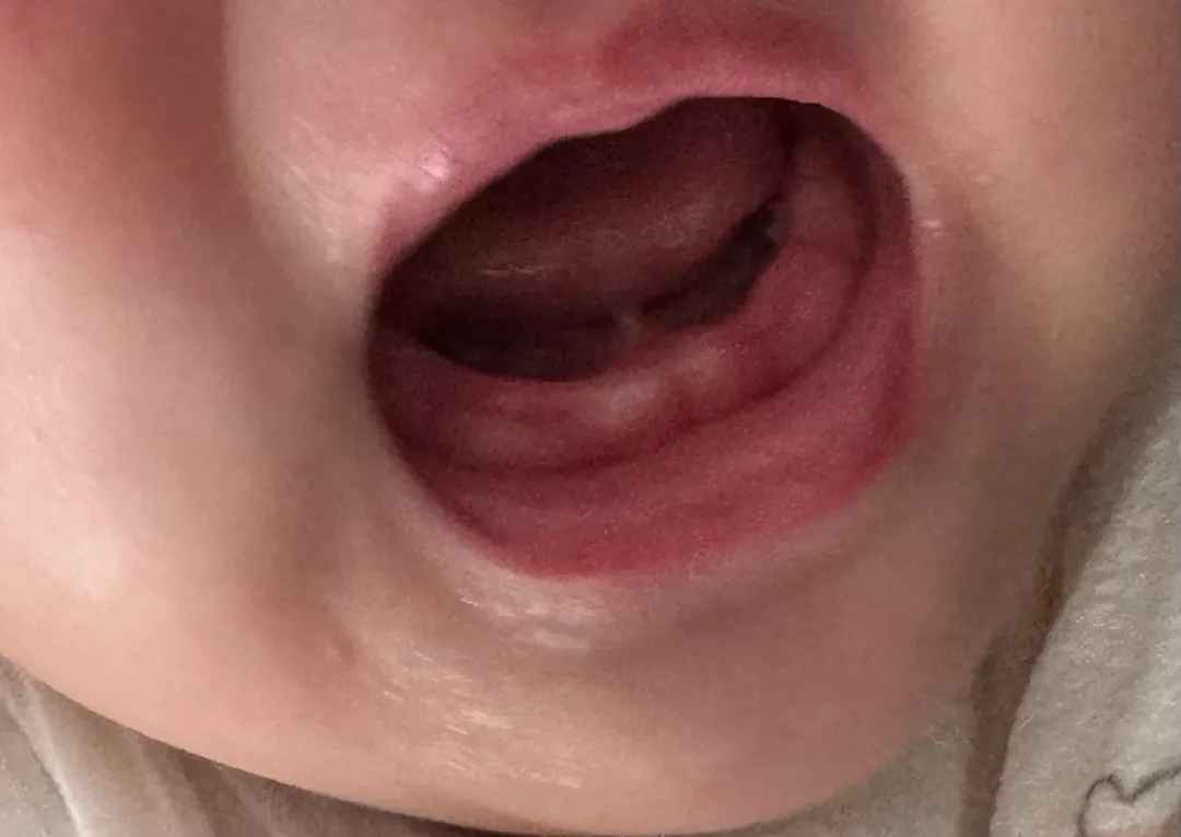 아기 첫 칫솔 추천해주세요!