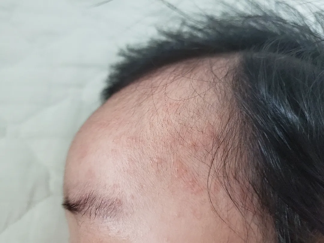 아기 피부 좀 봐주시겠어요?ㅠㅠ