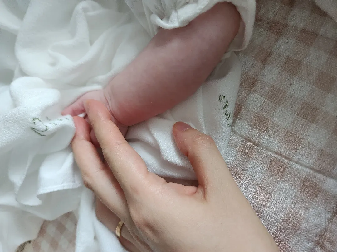 피부 드문 빨갛고 파래요 ㅠ