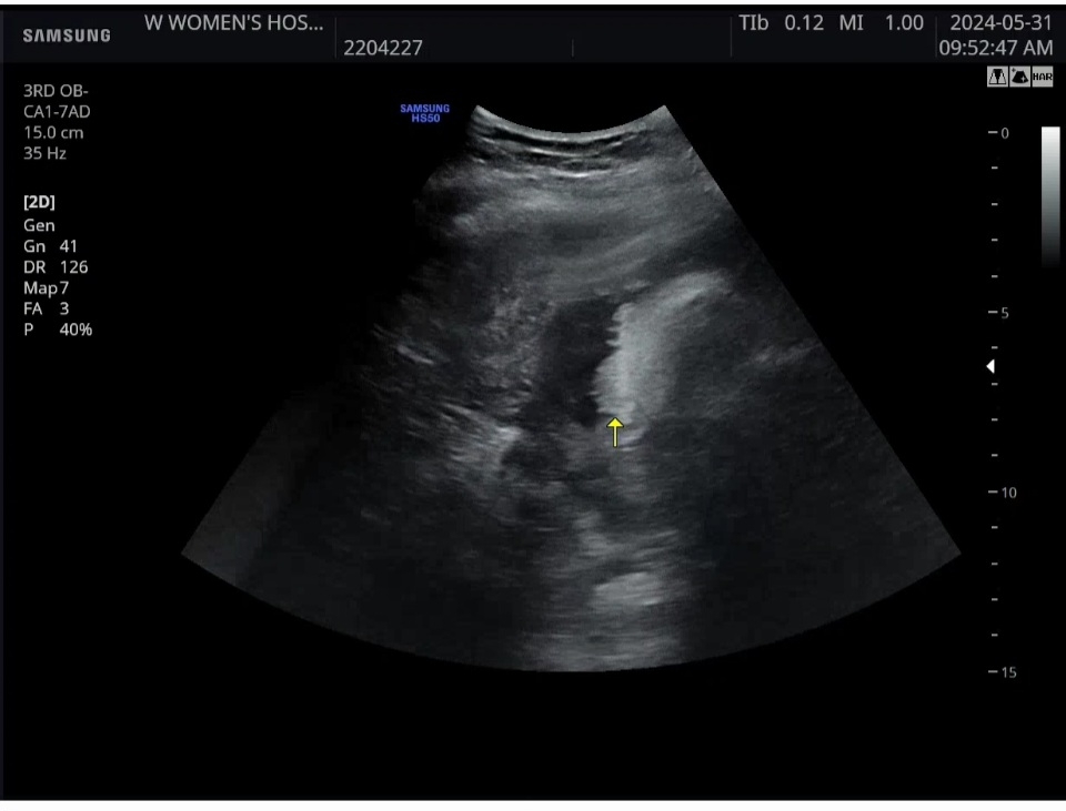 오와.. 머리카락보고왔어요🤣