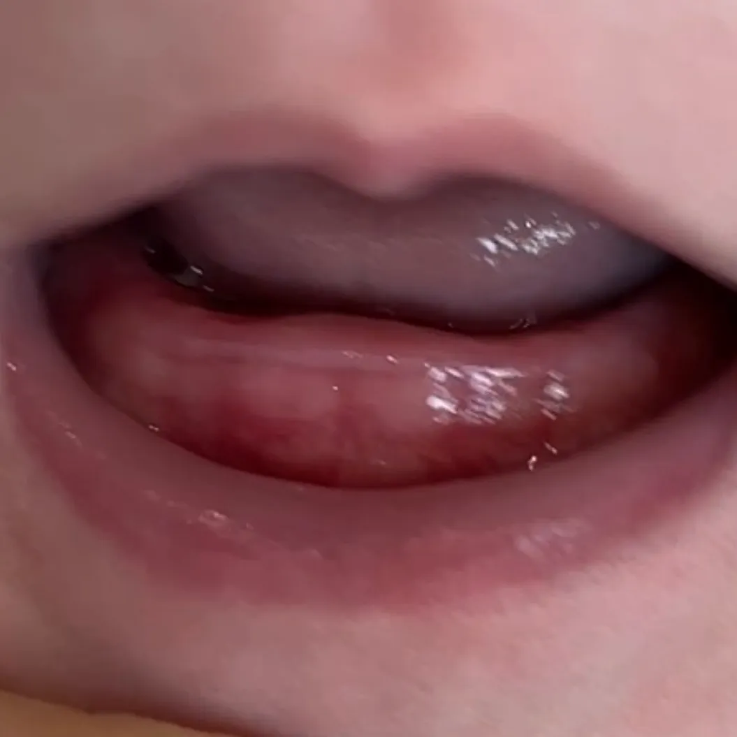 이가 나려고 하는게 맞을까요 ??