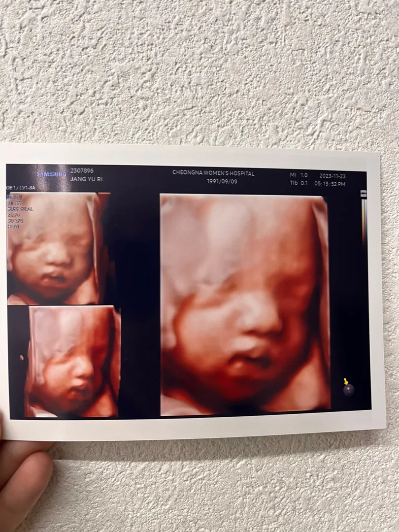 입체 초음파 이정도면 잘나온거죠!?ㅎㅎ
