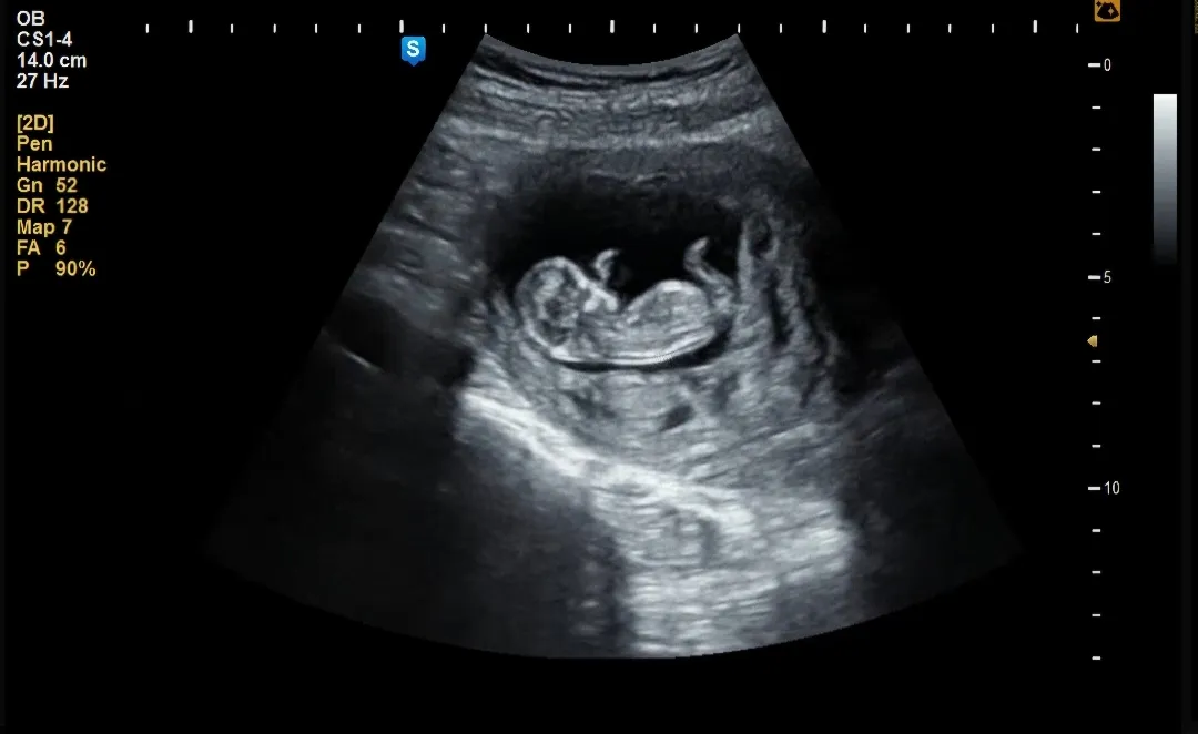 11주 6일 각도법 봐주세요오👶