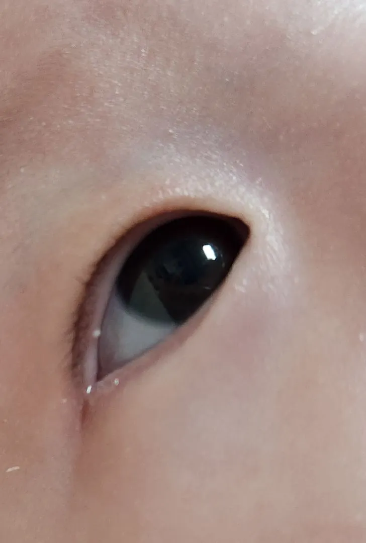 아기 눈꺼풀..