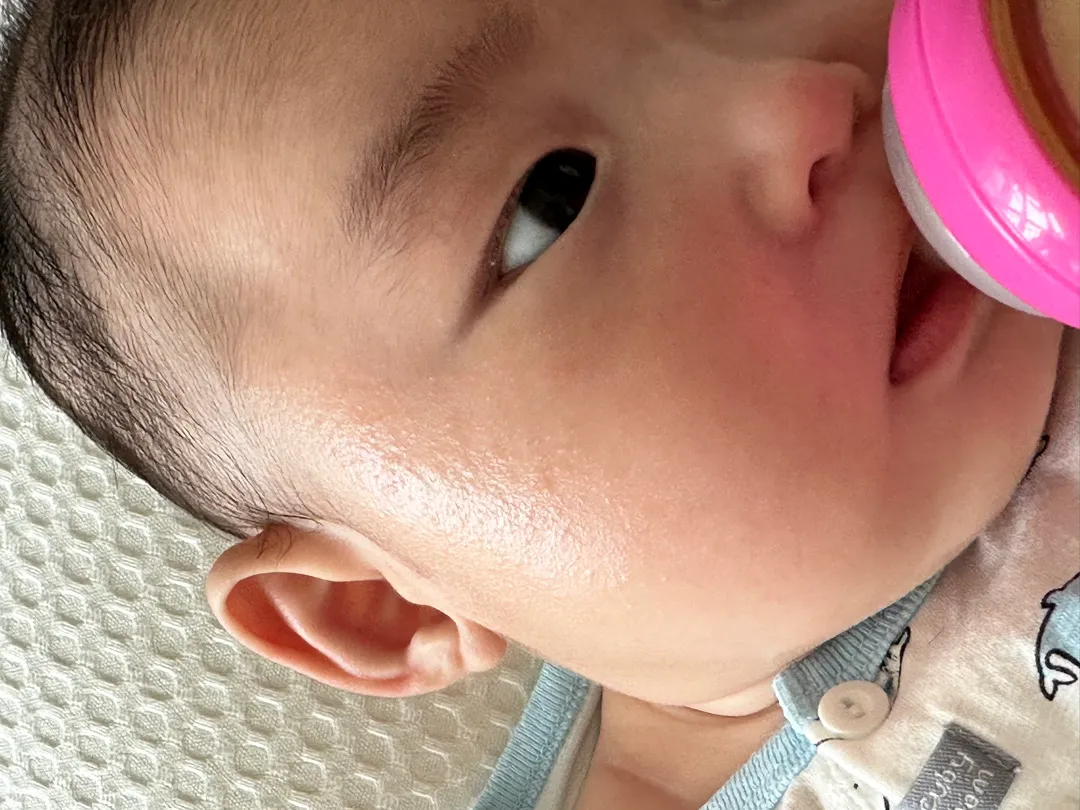 아가 태열 어떤제품 좋을까요 추천 부탁드려요😮‍💨