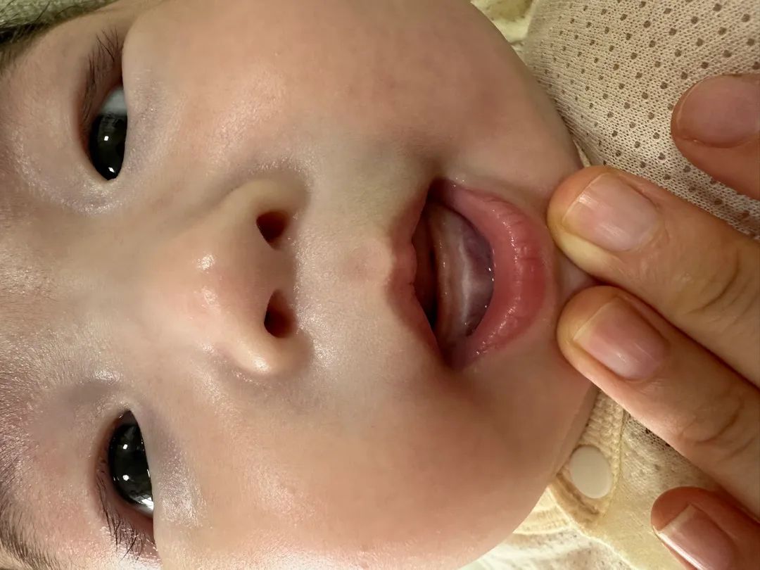 잇몸을 한번 같이 봐주세요🥹