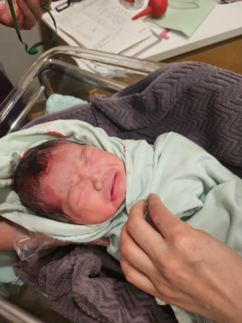 40주 2일. 3.6kg 머리둘레10.2cm 자연진통 없이 시작한 유도분만 성공!
