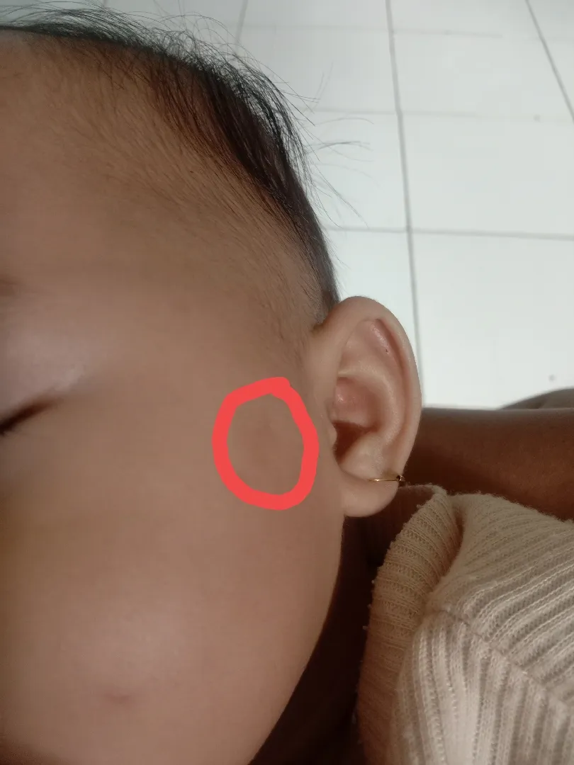 Kulit menghitam