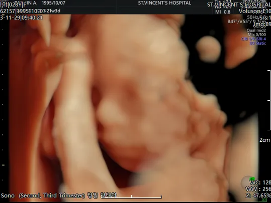 정밀초음파 하고 왔어요! 다행히 정상 통과