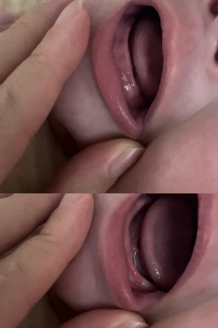 106일 남아 뒤집기에 이앓이? 원더윅스? 미치겠네욤ㅜㅜ