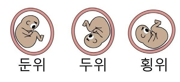 32주차 어머님들 아기 머리가 밑으로 위치해 있나요?