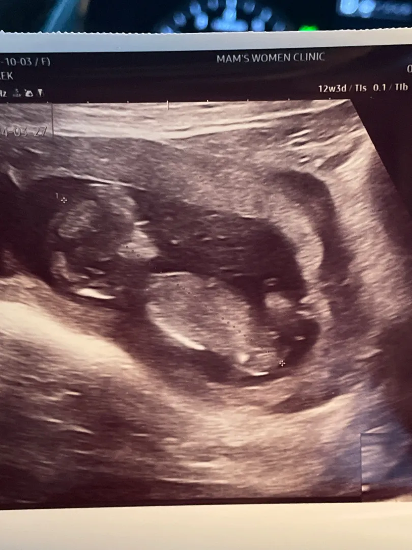 성별한번 봐주세여💕👶🏻