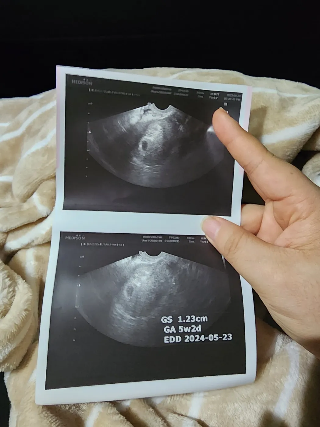 아기집 또보고왓어용