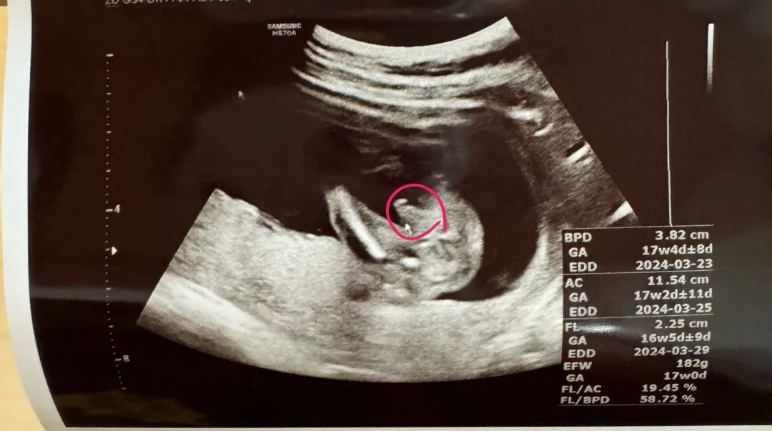 16주 🌶️가 너무 커요