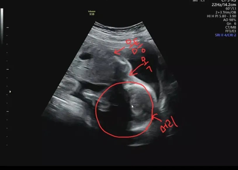 아기 자세 너무 불편해보여요
