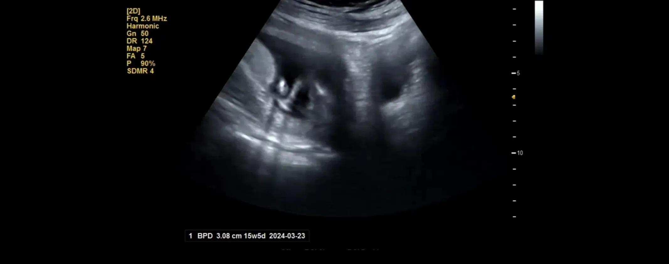 15주 1일차 성별 👶