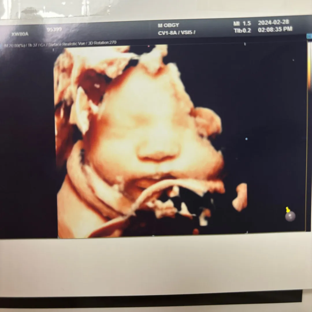 34주 6일인데 태동이 약한거같아서