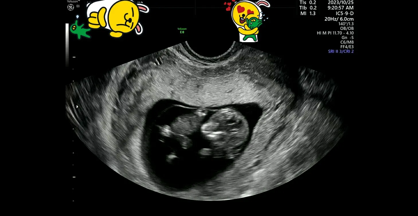 뒤늦은 젤리곰..(?) 보고 가세용♡ ☺
