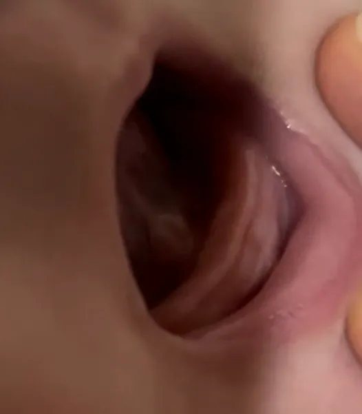 이앓이 수유량