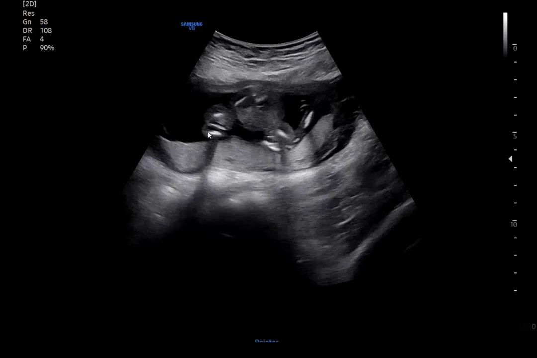 16주 6일이예요