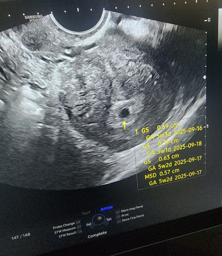 오늘 아기 집들이 하고왔어요🥹