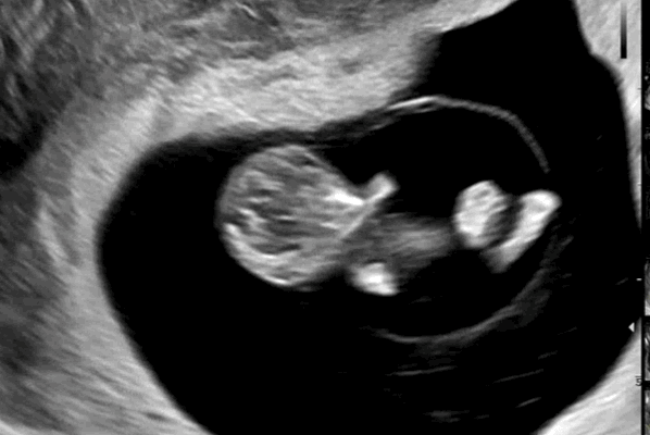 저희집 꼬물이 댄스 보고가세요 👶🏻