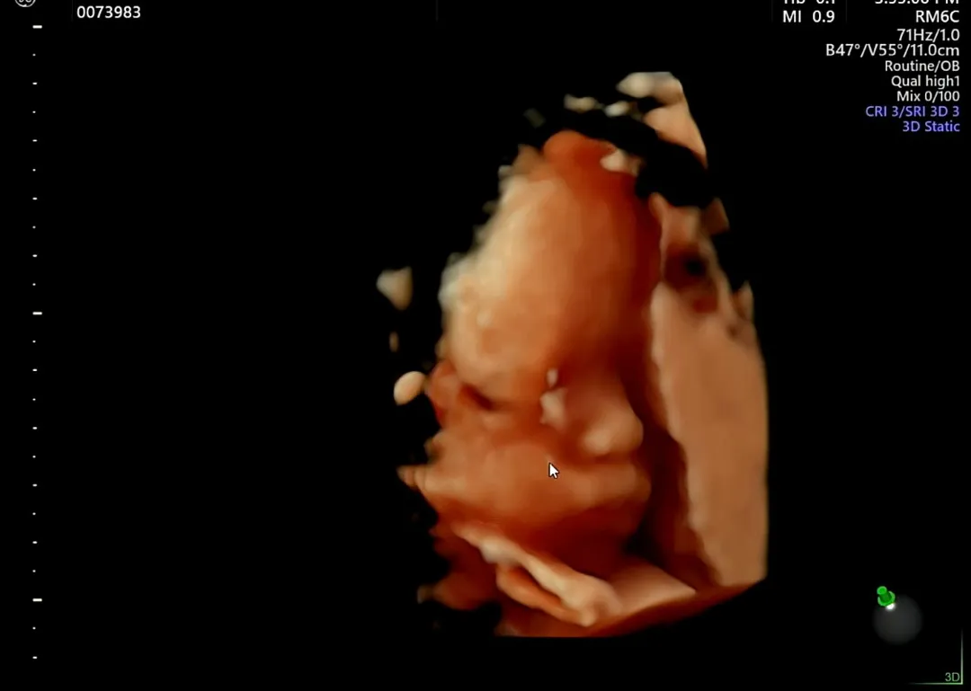 저희 애기 콧대 좀 봐주세요~~