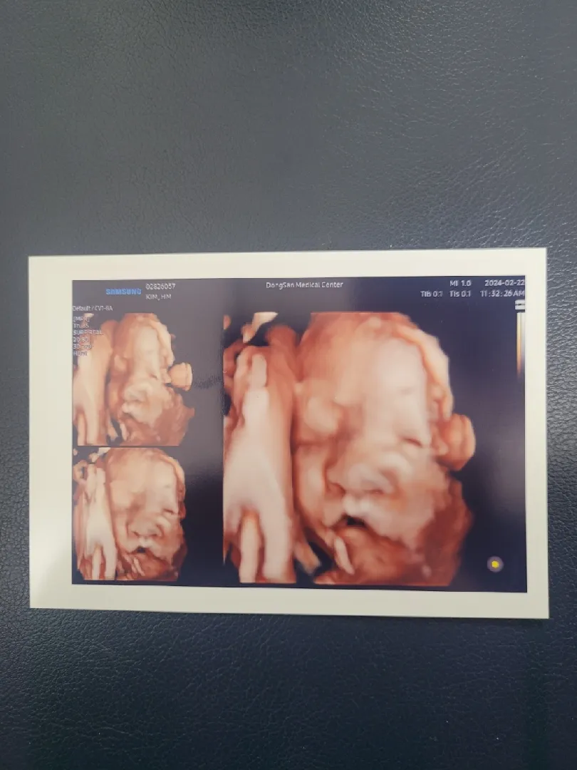 우리애기 어렵게얼굴봤어요ㅎ