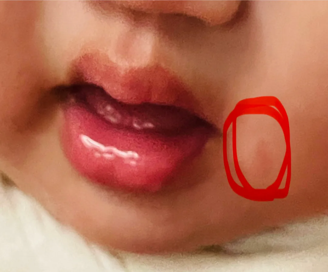 입주위 건조함