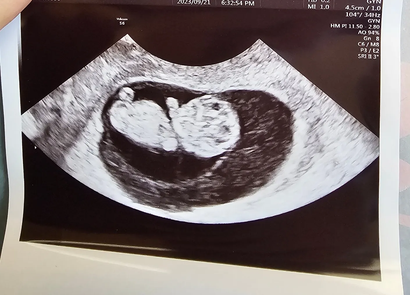 복떡이 보고왔어요~!!