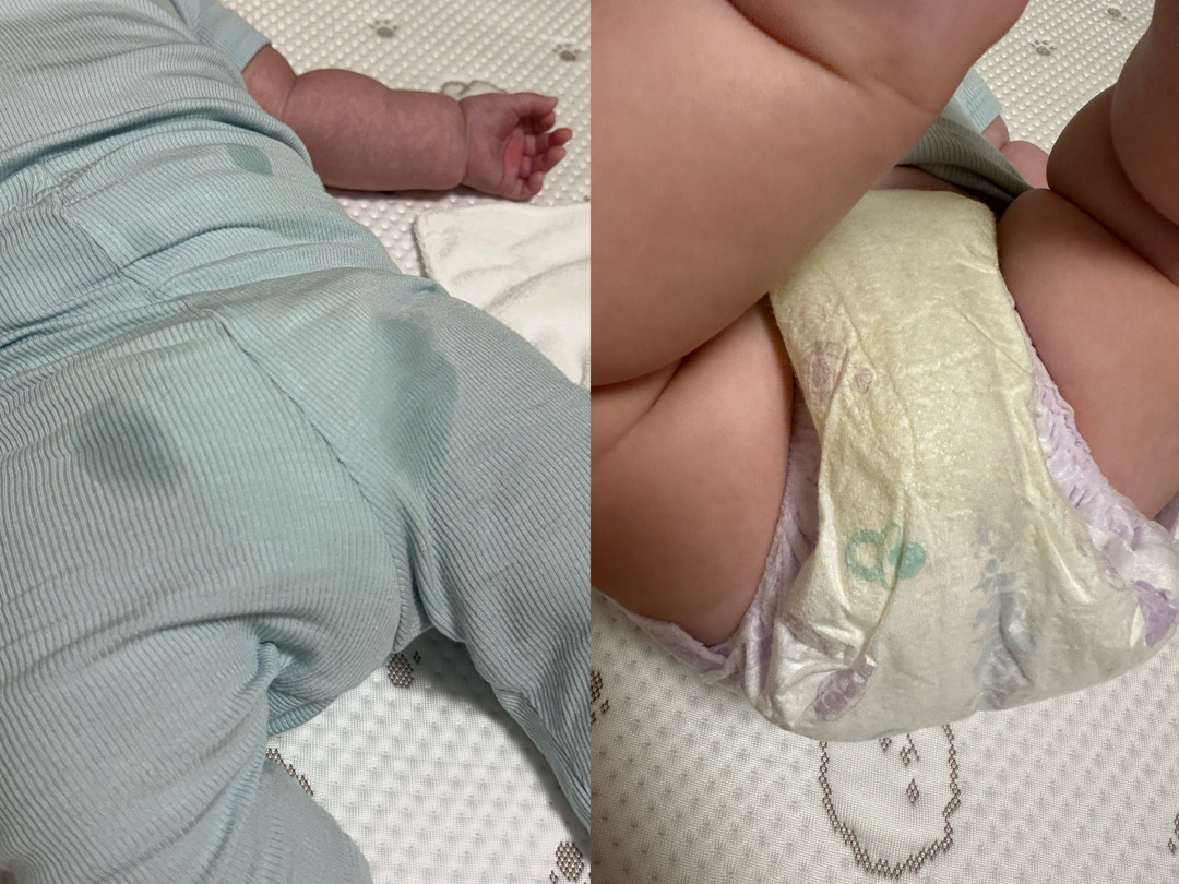 아침에 기저귀 세는데... 원래 이런건가요?