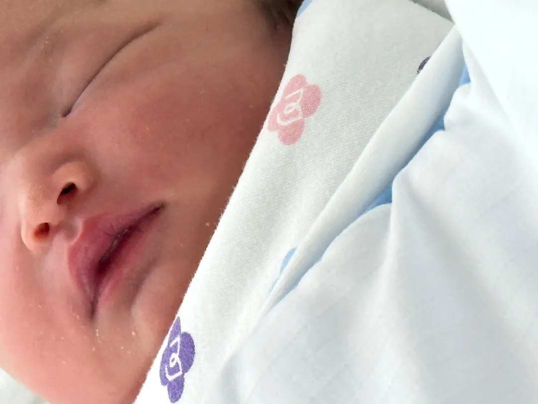 선택제왕 날짜 잡아놓고 36주에 양수 터져서 애기 낳았어요👶