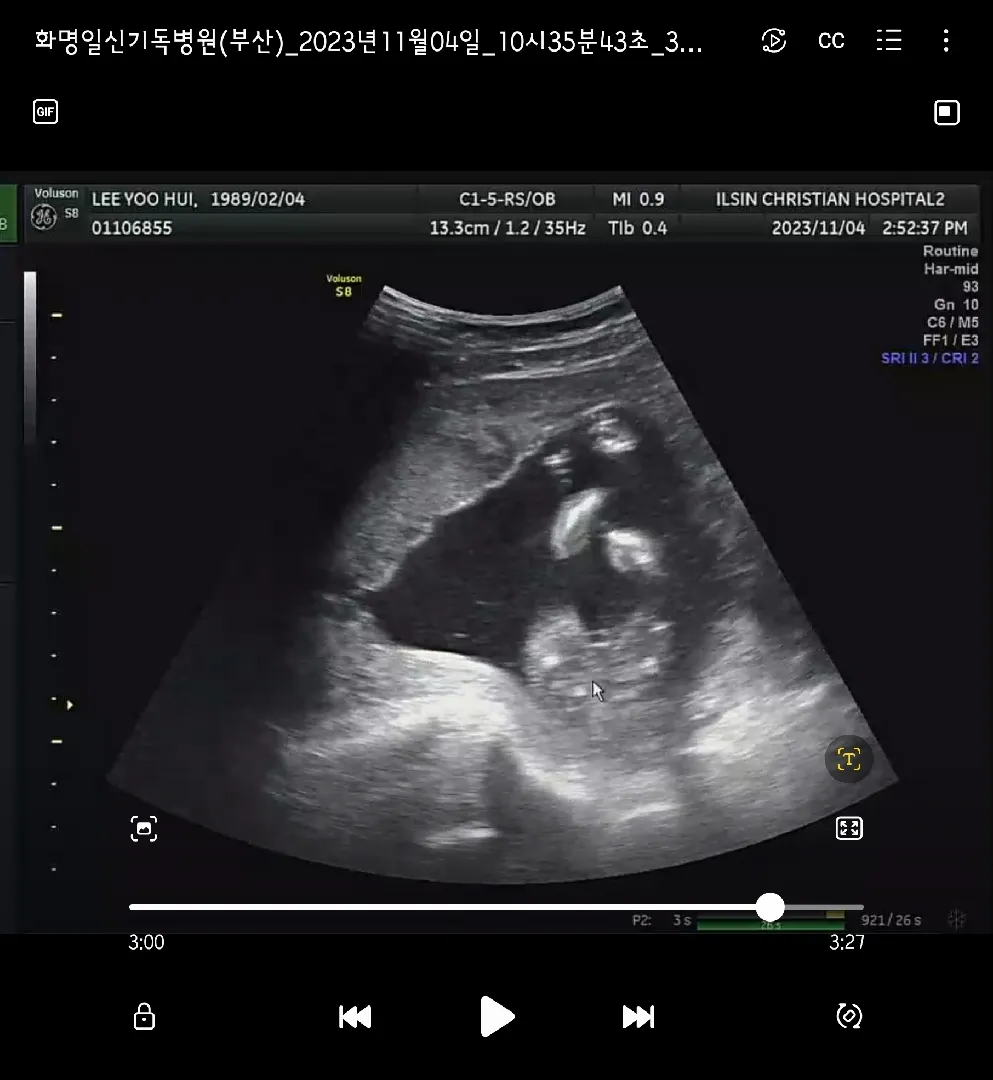 16주 2일 초음파 보고왔어요~