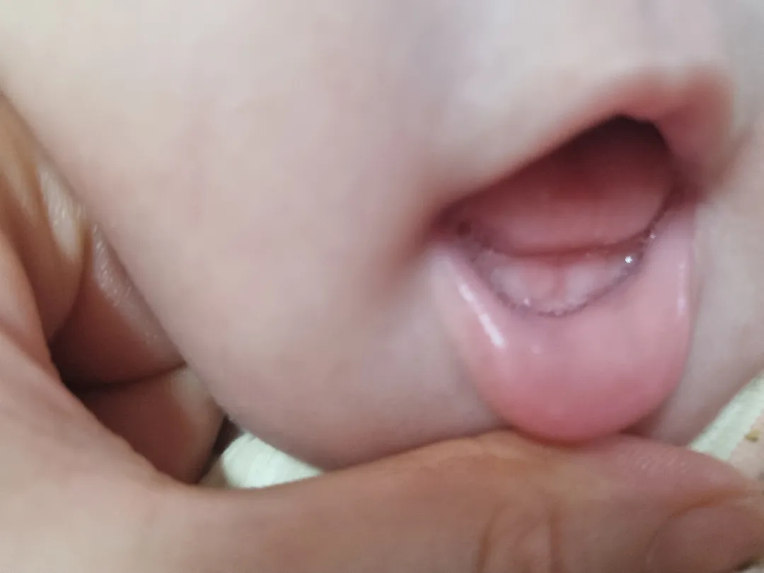 이앓이일까요?