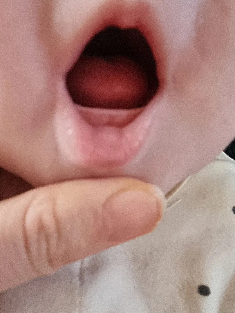 이거 진주종일까요 이빨일까요???