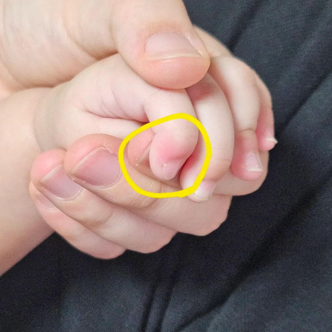 아기 손톱