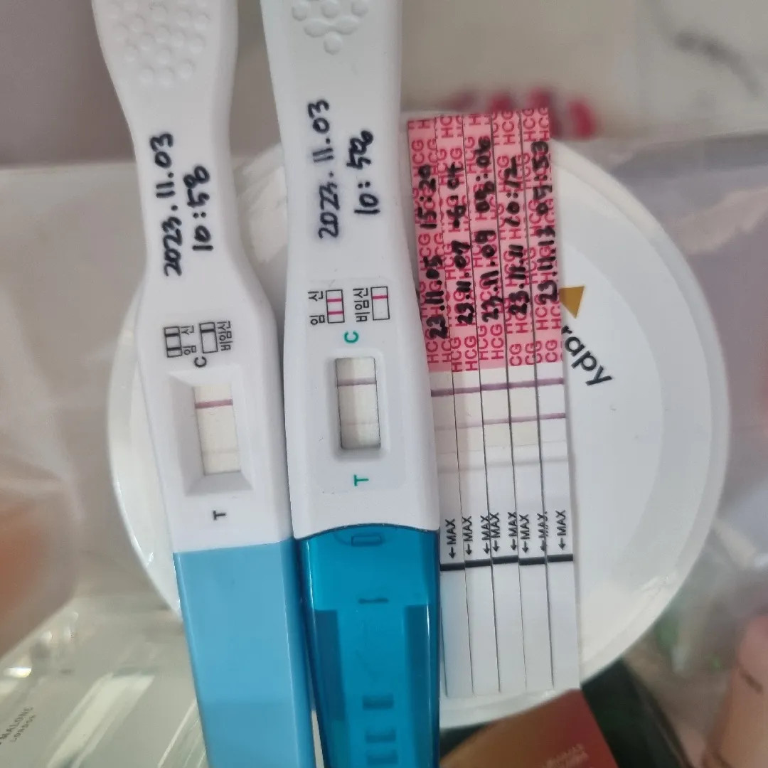 계유 후 임신