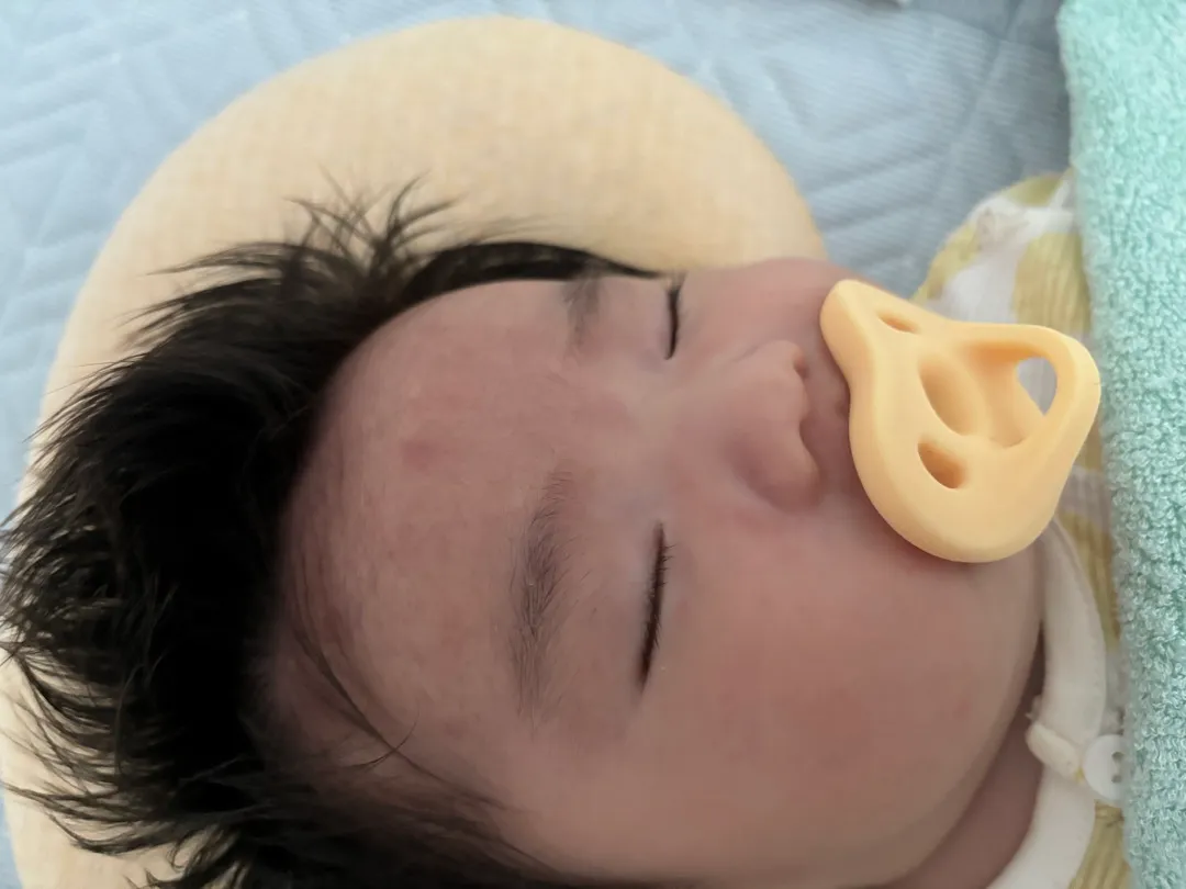 얼굴에 갑자기 머가 났어요