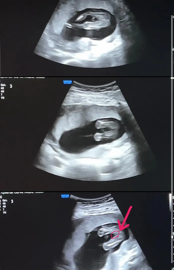 🌶️ 보이시나요ㅋㅋ